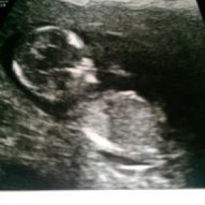 The first picture of our second baby :)